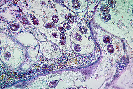 感染肝脏中的虫子 100x寄生虫蠕虫细胞病理科学组织学宏观疾病药品组织图片