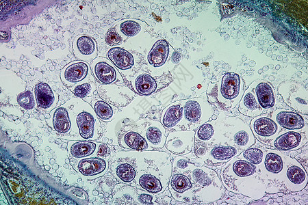 感染肝脏中的虫子 100x科学细胞病理药品组织学组织寄生虫疾病蠕虫宏观图片