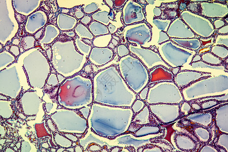 100x 甲状腺有科类甲状腺疾病细胞病理科学宏观放大镜红色组织学薄片组织胶体图片