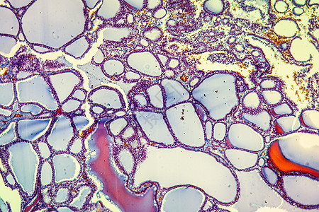 100x 甲状腺有科类甲状腺疾病科学放大镜病理宏观红色组织学薄片组织胶体细胞图片