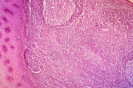 100x 发炎疾病组织病原100x宏观组织学放大镜红色腐烂病理感染药品科学细胞图片