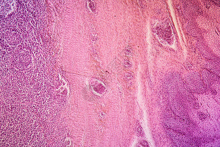 100x 发炎疾病组织病原100x宏观腐烂病理红色感染细胞薄片组织学放大镜科学图片