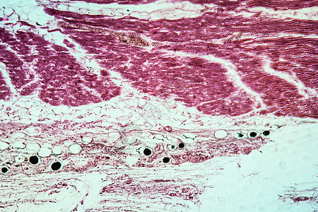 100x 患有组织疾病皮肤癌薄片皮肤病理癌症放大镜水仙细胞组织学科学结核图片