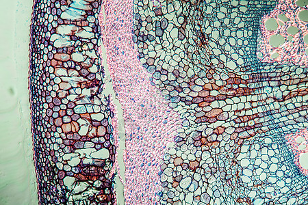 管道灌丛 有100号干线放大镜宏观灌木红色细胞组织植物制管组织学科学图片