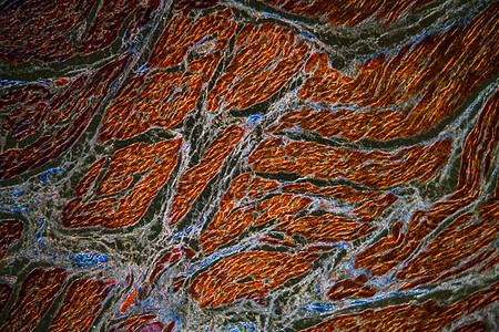 肌肉组织 含共合物的肌肉组织增加100x宏观细胞组织学暗场薄片肌纤维胶原放大镜科学图片