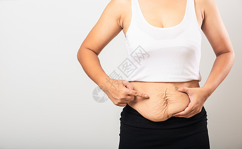 女人指着伸展的印记 松松下腹部皮肤肚子皮肤科女性女士女孩婴儿身体重量妈妈分数图片