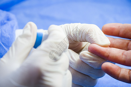 胰岛素测试过程 血液检测和注射器 注射到手中 病人和医生糖尿病药品考试皮肤治疗诊所手指卫生手套测量图片