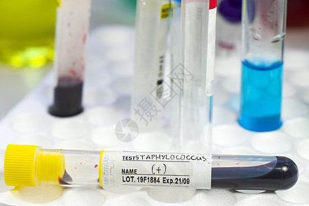 血试管样本 实验室和化学液体元素 COCPC 包括 活性细菌球菌测试疫苗制药保健科学疾病感染化学品图片