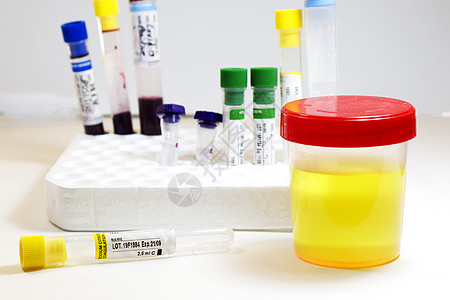 白底 彩色实验室检测容器上含血和其他管子的药物测试 医疗尿液和尿尿检验药品生物医学诊断服务液体控制诊所化学品分析图片