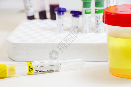 白底 彩色实验室检测容器上含血和其他管子的药物测试 医疗尿液和尿尿检验医院疾病液体药品化学品样本分析控制报告治疗图片