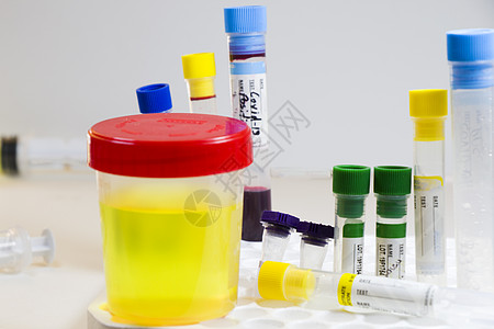 白底 彩色实验室检测容器上含血和其他管子的药物测试 医疗尿液和尿尿检验分析生物药品疾病尿素诊所化学品报告医学医院图片