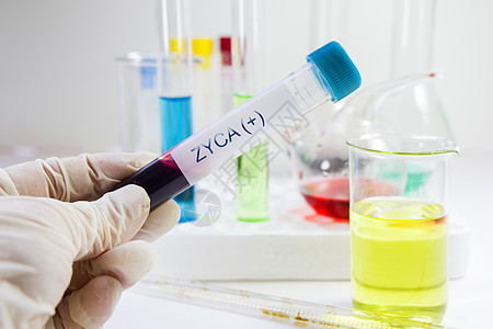 Zyca病毒 血液测试管样本 实验室和化学液体元素 COCB科学微生物学制药病原疫苗化学品卫生临床恢复期细菌图片