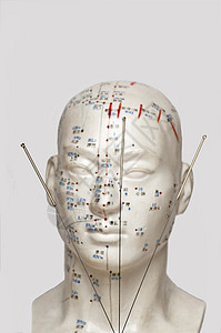 头型针刺针头康复疗法繁体示范自然中医保健治愈者药品卫生图片