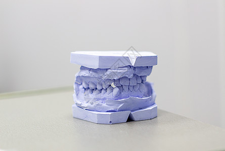 整牙师用石膏涂上牙膏结盟牙模技术员陶瓷口腔科实验室脚印塑料烙印制品图片