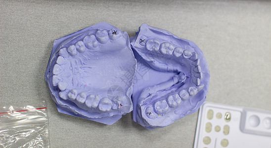 整牙师用石膏涂上牙膏矫正牙齿生产制品结盟诊所牙模医生技术员塑料图片