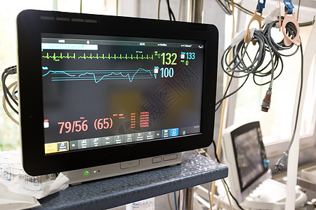 医院急诊室的电动心电图单位监视器图片