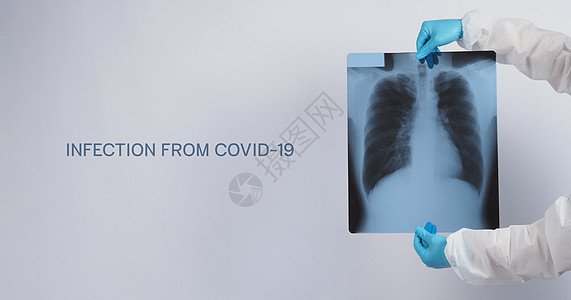 Covid 19肺损伤的X光薄片和医生手用医疗手套和个人防护设备托持病人疾病x射线扫描癌症结核流感电影诊所卫生图片