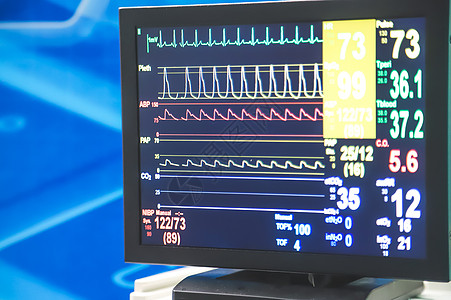 监测病人的病情和生命迹象 在医院 特别护理中配备监视器重症心脏手术药品医疗手术室展示生活技术医生图片
