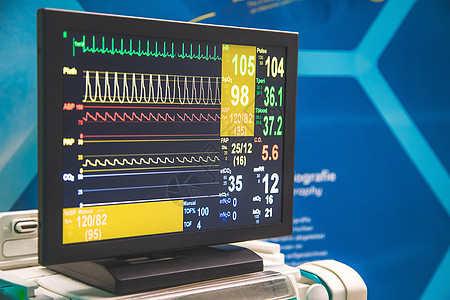 监测病人的病情和生命迹象 在医院 特别护理中配备监视器展示诊所手术监视重症电脑生活心电图医疗体系图片