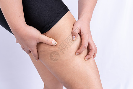 女性握住并推动腿部橘皮组织的皮肤 治疗和处理超重皮下脂肪组织沉积臀部内衣按摩内裤脂肪橙子屁股腰部饮食障碍图片