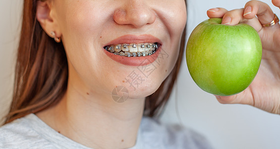 一个牙齿上有牙套的女孩 想要咬一个绿苹果女士牙科技术治疗刷子压力生活矫正口腔科女性图片