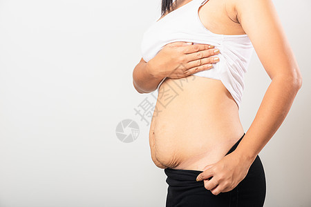 孕期婴儿出生后脂肪的低腹部皮肤松动 产卵后发胖怀孕饮食药品皮肤科瘢痕分数重量女性女孩妈妈图片