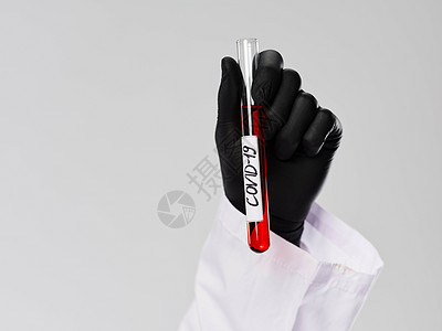 红色血液化验室技术员黑手套研究诊断结果的血液测试;实验室技术员背景