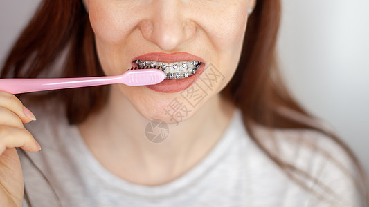 一个白牙牙牙和牙刷上有牙套的女孩牙齿刷子压力生活打扫橡皮口腔科卫生医生支架图片