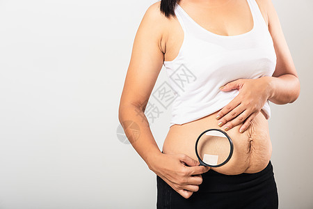 妇女使用放大玻璃展 在怀孕婴儿出生后脂肪的腹部皮肤松散 腹部皮肤变低图片