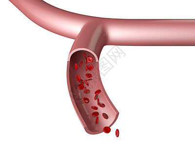 血血管图片