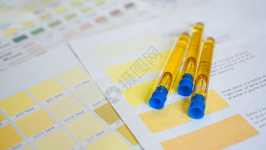 尿管被贴在彩色图表上 分析 诊断等概念审查尿素考试早餐医生肾脏尿酸持有者服务感染图片