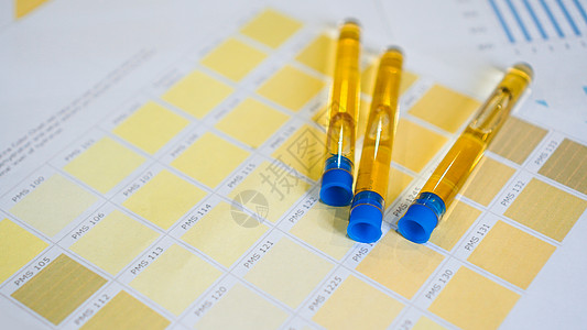 尿管被贴在彩色图表上 分析 诊断等概念科学治疗审查果汁尿酸健康肾脏桌子疾病尿液图片