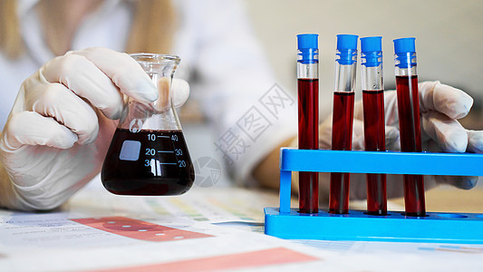 红色血液科学的手从站立处抽取血液采样管研究员临床实验室医院技术员护士化学品化学手套瓶子背景
