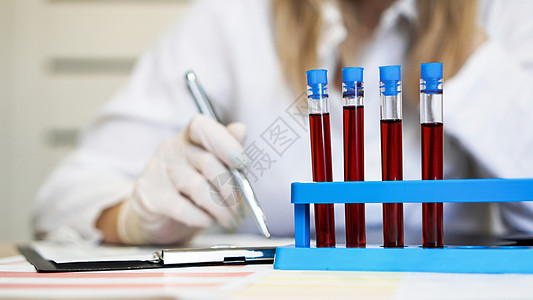 在化验室与血液样本一起工作的妇女 特查报告化学品微生物学临床药品疾病持有者女士器皿桌子图片