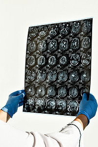 医生在医务室保护戴脑部核磁共振的手套 对诊所的人头进行核磁共振扫描检查扫描器疾病创伤癌症技术卫生治疗职业防护图片