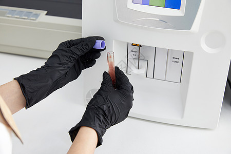 女研究科学家将装有血样的试管放入分析仪医疗机器中 科学家在实验室使用现代医疗设备医生显微镜微生物学液体检查离心机药店女士药品技术图片