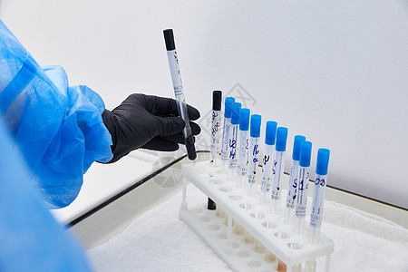 试验管架 在现代实验室的桌子上摆有病理样品管子医学液体化学护士医院微生物学研究代码酒吧图片
