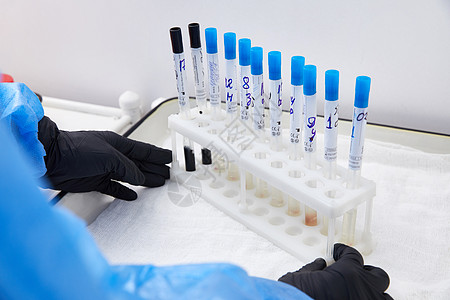 试验管架 在现代实验室的桌子上摆有病理样品试管微生物学架子液体临床管子研究生物医生技术员图片