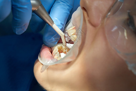 病人治疗期间使用空气喷水喷洒的牙科医生女性手术外科诊所牙齿单元助手诊断男性风镜图片