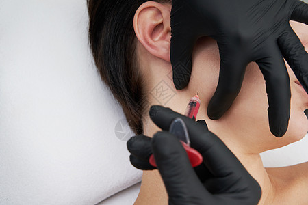 美丽的女人在脸上注射一针填料女孩诊所护理嘴唇女性外科化妆品手术治疗图片