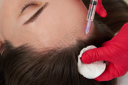美容医生在美丽的年轻女性患者头部进行透明质酸嫩肤美容注射 以促进头发生长和防止大胆外科手术女孩化妆品脱发药品护理诊所保健治疗图片