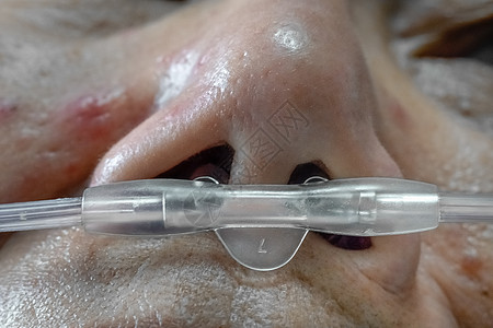 对老年病人的药物性错误影响鼻音治疗鼻子录取医师退休管子药物药品女性图片