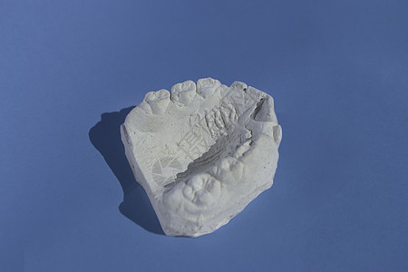 牙科牙牙膏石膏模型铸造形态学人类下巴模具技术磨牙牙医矫正假肢卫生药品科学牙模图片