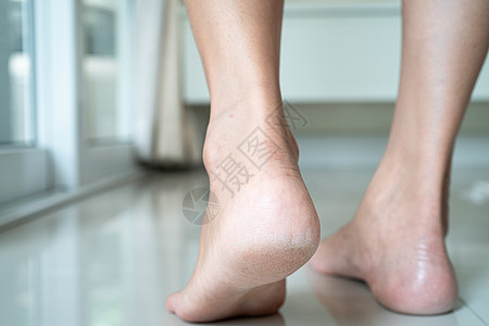 妇女脚踝受伤伤人 妇女触摸脚踝疼痛皮肤药品女性糖尿病髌骨工作女士骨科伤害运动员图片