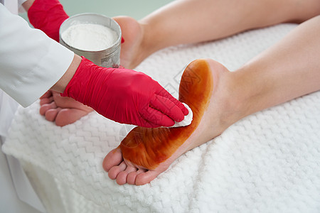 准备在女性脚部注射肉毒毒素的医生 以预防过重中毒 过度出汗以及程序注射器美容气味女士化妆品汗腺病人身体卫生图片