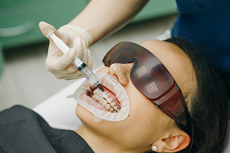在牙科诊所嘴里有扩张器的年轻女子 美丽的笑容 牙齿的健康 牙医口腔科医生在医学牙科诊所为病人美白牙齿图片