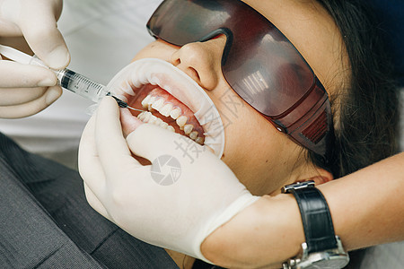 在牙齿上涂抹保护性美白凝胶 在牙科诊所嘴里有扩张器的女人 美丽的笑容 牙齿的健康 牙医口腔科医生为病人美白牙齿图片