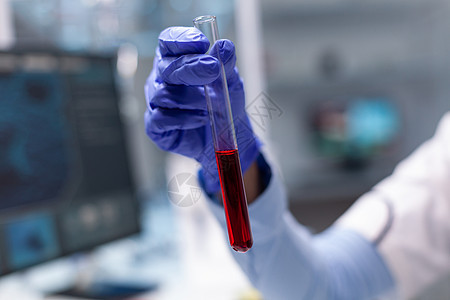 在微生物学实验中手持血液试管的医生研究员图片
