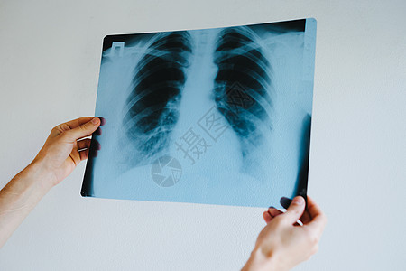 一个人肺部的X光片身体放射科哮喘科学肺炎医院扫描解剖学护士活检图片