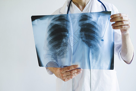 医生对肺部进行X光检查 国际医生日 前排的医生 请到医院来放射科药品解剖学诊所哮喘科学扫描脊柱身体从业者图片